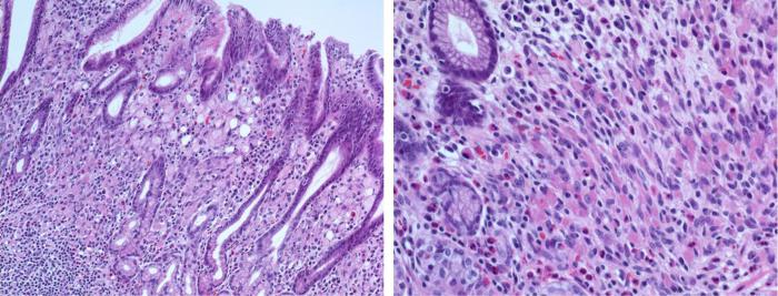 Qual è il citoplasma della cellula. Caratteristiche della struttura del citoplasma