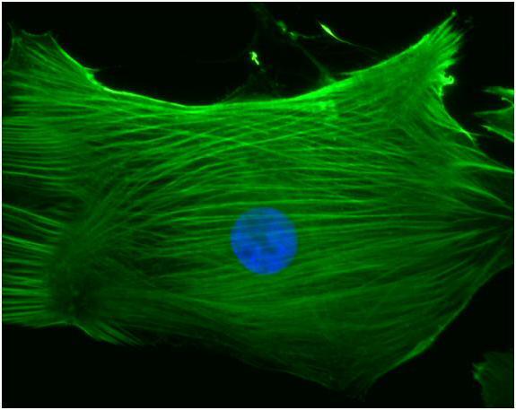 Funzione ialoplasma