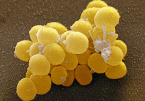 Tipi di organizzazione cellulare di microrganismi