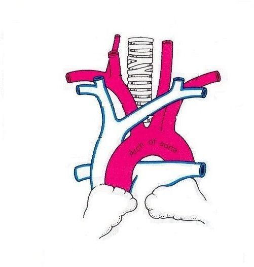 anatomia dell'aorta 