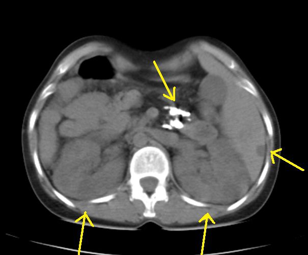 Qual è la differenza tra MRI e CT? In quali casi la risonanza magnetica è migliore della TC?