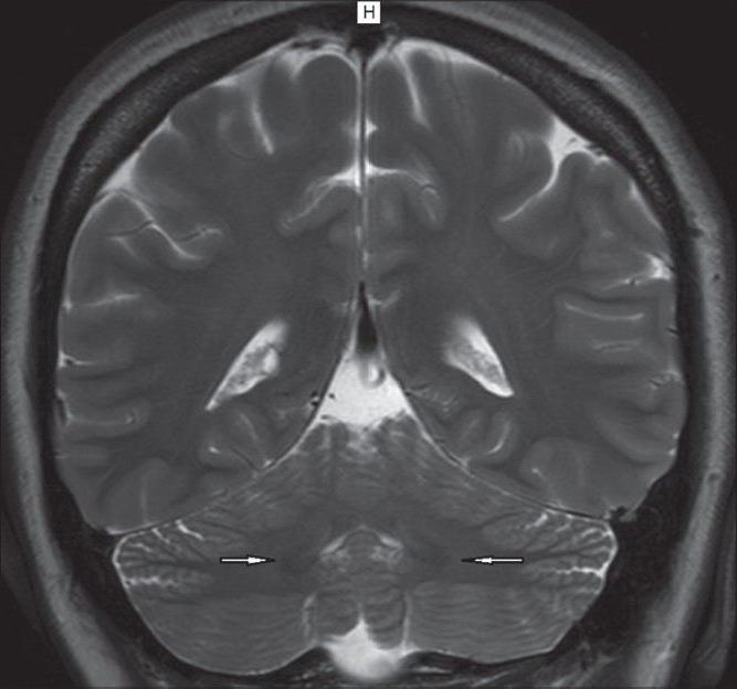 Qual è la diagnosi di risonanza magnetica? Possibilità di diagnostica MRI. Diagnosi della risonanza magnetica cerebrale. Recensioni su diagnostica MRI