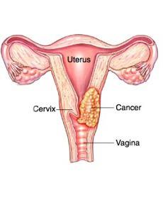 foto endocervix