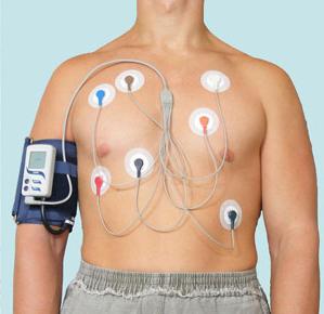 Monitoraggio Holter dell'ECG