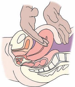 involuzione dell'utero