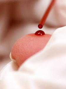 Monociti: la norma nel sangue di donne e bambini