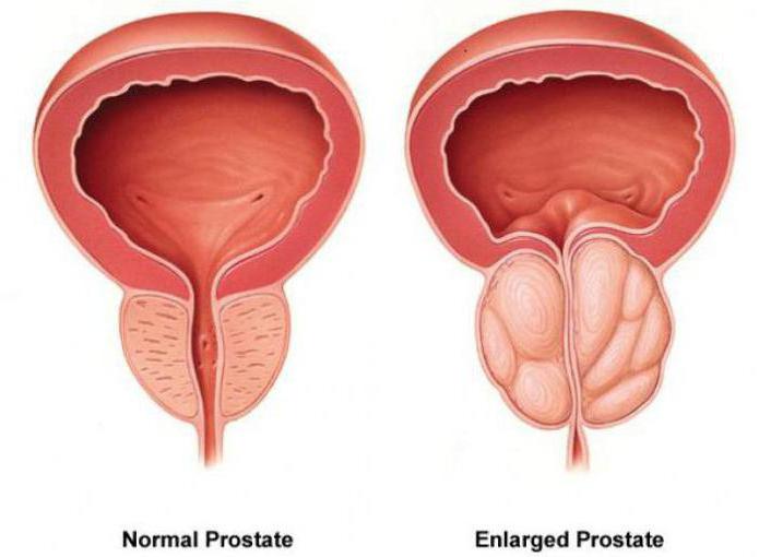 istruzioni prostaplan per la revisione del prezzo d'uso 