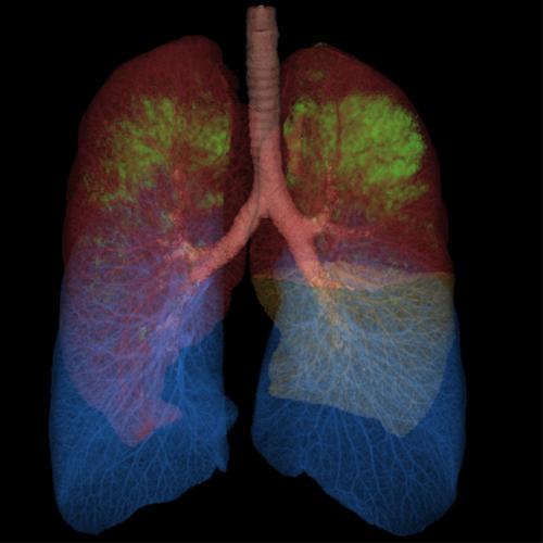 Segmenti del polmone Segmenti polmonari